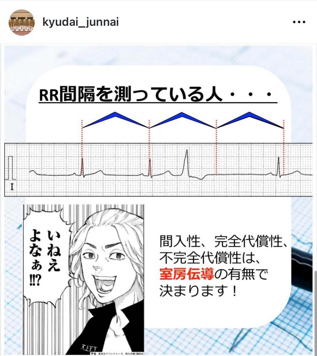 yakabe1206's tweet photo. 九州大学循環器内科では、心電図・循環器を学ぶみなさんを応援しています📣
Instagramには心電図検定対策として講義スライドを載せていますので、ぜひフォローしてください💕

https://t.co/1tdLjncgCd https://t.co/MzXRiSWNO5