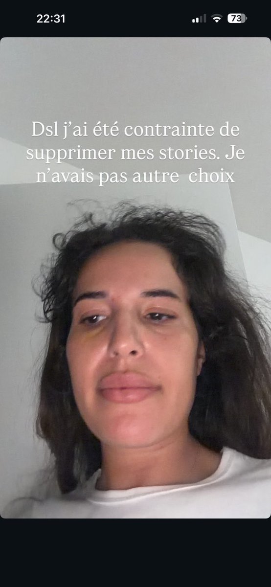 𝐸 tweet media