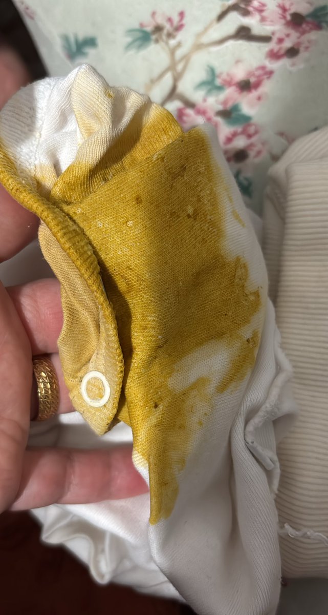 En iyi marka molfixsi kullanıyorum kullanıyorum yine sızdırıyor <a href="/molfix/">Molfix</a> o kadar para veriyorum yazık günah