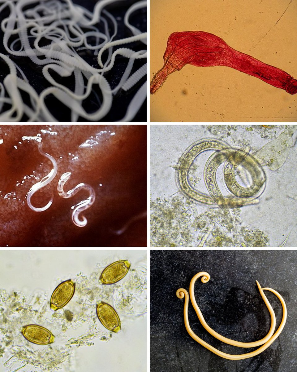 PWB_Global's tweet photo. Helminths belong to four phyla: Nematoda (roundworms), Platyhelminthes (flatworms), Acanthocephala (spiny-headed worms), and Nematophora (hairworms). Only worms belonging to the first three phyla are parasitic in humans. Both the Nematoda and Platyhelminthes have many free-living species as well.

Page 5 📕 Parasitic Diseases, Eighth Edition

Download a copy for free! https://t.co/xu6cN99Rjr