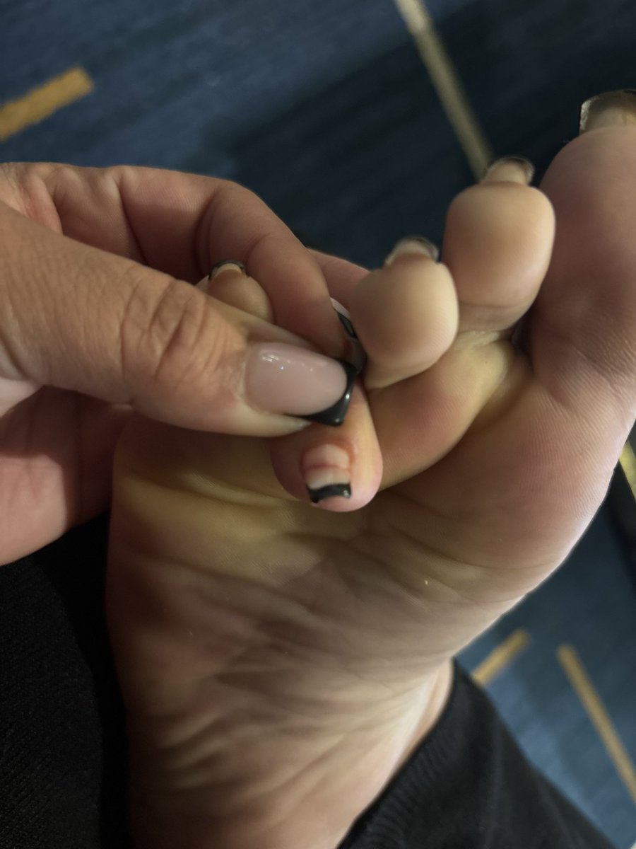 EMS2026EMS's tweet photo. Literally hurts worse than a break up πππ #realnails #realpain https://t.co/6C4YkvutcK