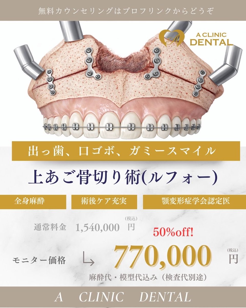 6zKVomo3Yf92819's tweet photo. 2026年6月までオペ室オープンキャンペーンとして、モニター特価とさせていただいております。骨切りが、麻酔代込みで最大50%オフ!症例が集まり次第、終了予定。先着順とさせていただきます🙇♂️#骨切り #両顎手術 #受け口 #口ゴボ #出っ歯 #顎なし https://t.co/vr7Gh0AmqQ