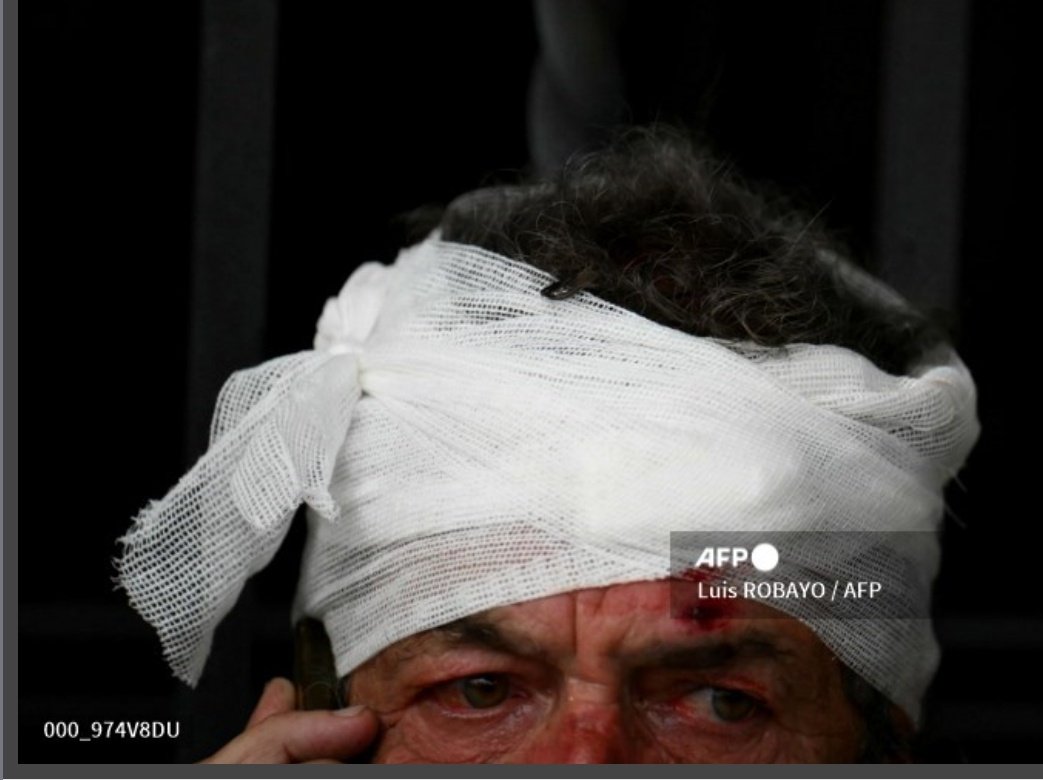 "Hay que ser un cagón para no defender a los jubilados". 

Miércoles de protestas en Argentina, frente al Congreso de la Nación, mientras se debate la reforma laboral. 

Fuerzas de seguridad atacaron a ancianos y  a periodistas. 

📷: <a href="/LuisRobayo/">Luis Robayo</a>
