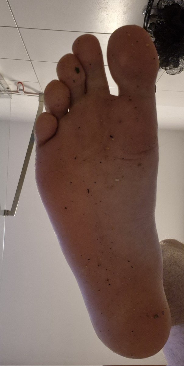 keampferrobin's tweet photo. Wer von euch würde meine Füße gerne Sauber lecken damit ich nicht duschen muss 🤔😜
DM 🤑💸 https://t.co/sJUx8JojJZ