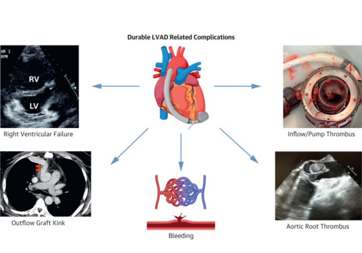 Anju Bhardwaj MD FACC tweet media