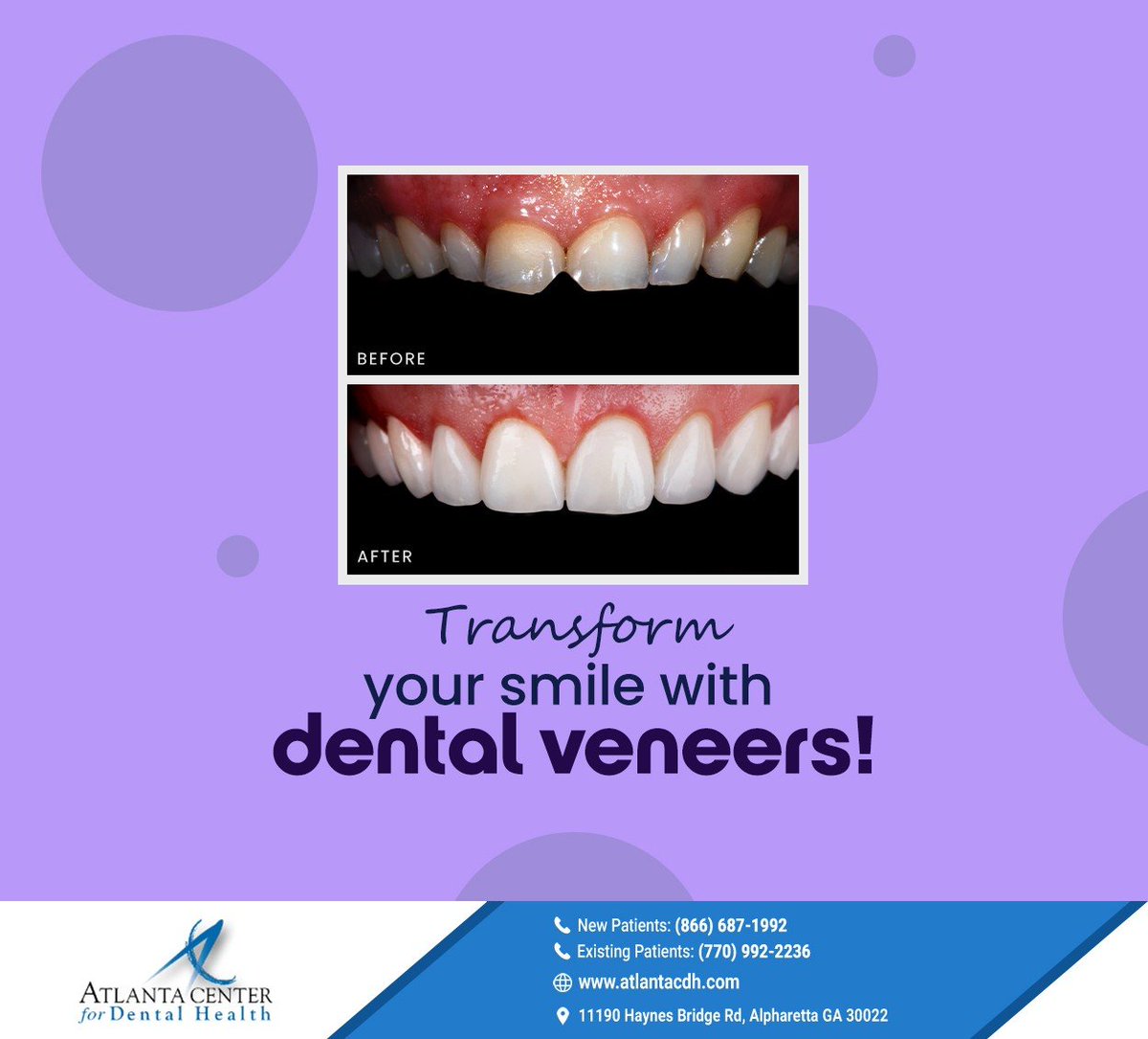 drhepler's tweet photo. Restore your smile with the help of dental veneers. Schedule a consultation at https://t.co/5e6szTYJRk to learn how veneers can transform your smile. #dentalveneers #smiletransformation #smilewithconfidence #atlantacenterfordentalhealth #alpharetta #GA https://t.co/Vm5qgjKfMO