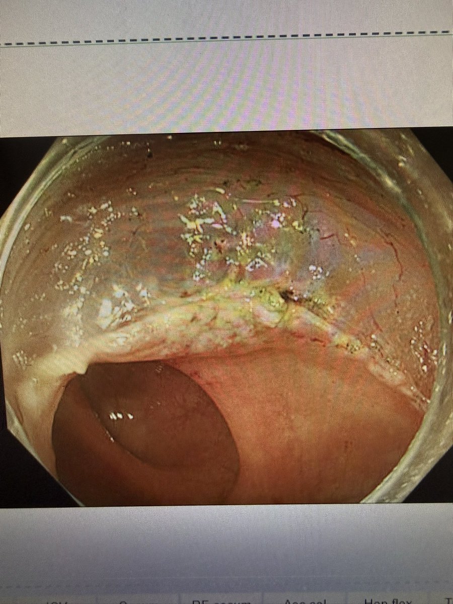 Amaninder Dhaliwal tweet media