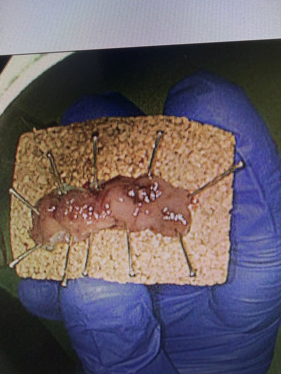 Amaninder Dhaliwal tweet media