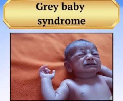 Which drug is contraindicated due to risk of gray baby syndrome?

A.Chloramphenicol
B.Penicillin
C.Ceftriaxone
D.Azithromycin
#ชลบุรีเขต1 #ImranKhanHealthEmergency #Yeralti