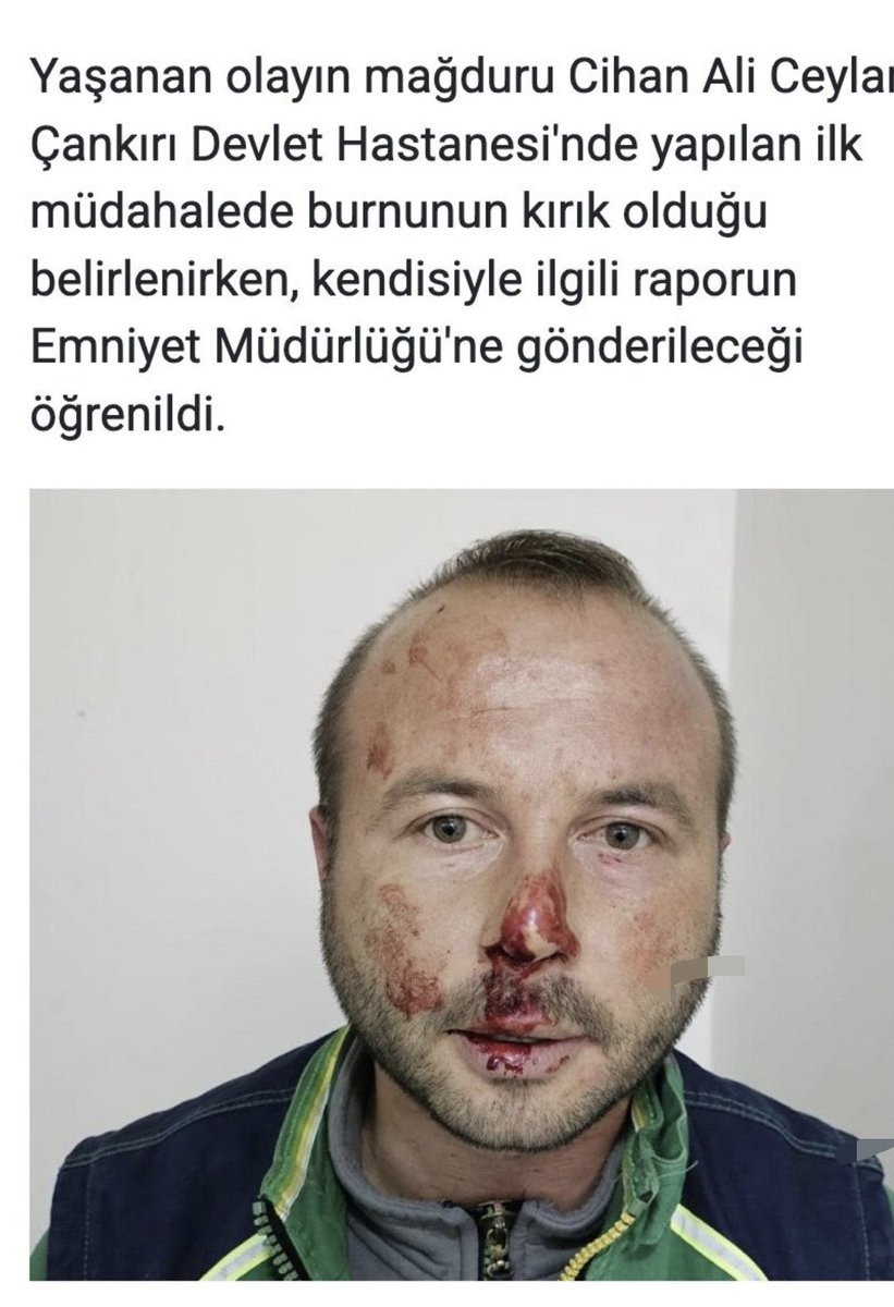 cesko34's tweet photo. @Fikret_ozer00 Polis dövmenin zararları tahribatı arttırır ve yan etkisi var ☠️ https://t.co/YpUtzQcboW