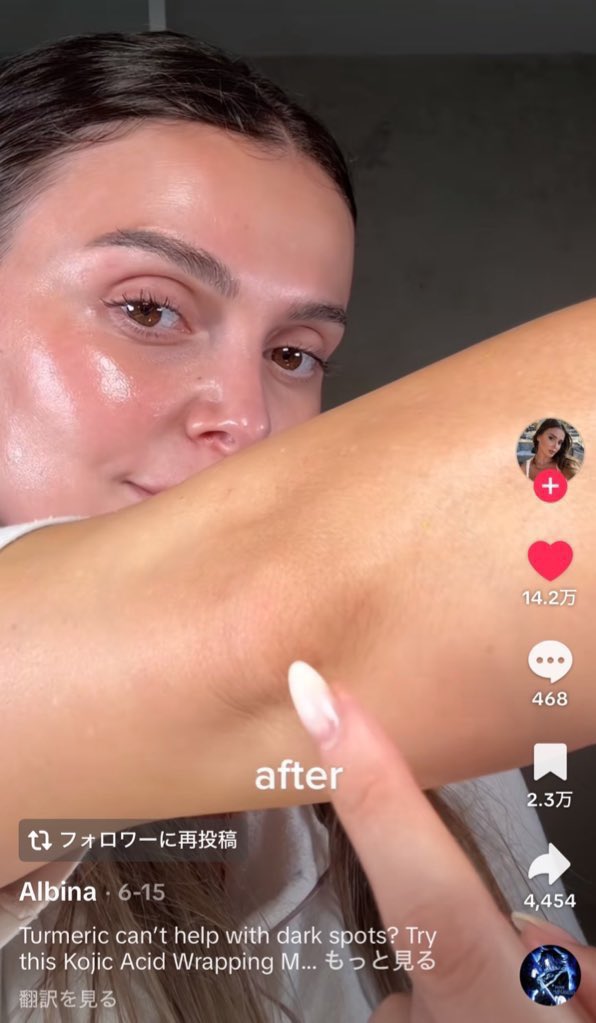 下の黄色シリーズの効果は、まじレベチ。
ピコレーザー級に効果あるww