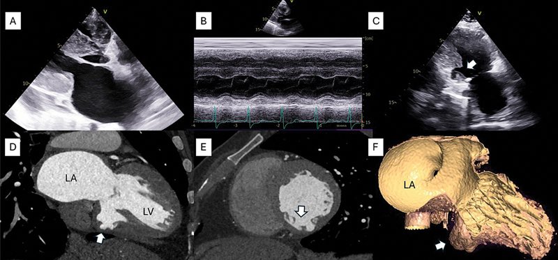 Dr Damandeep Singh, MBBS, MD, DM tweet media