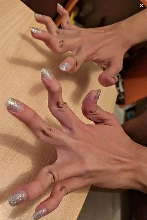 What is this diagnosis?