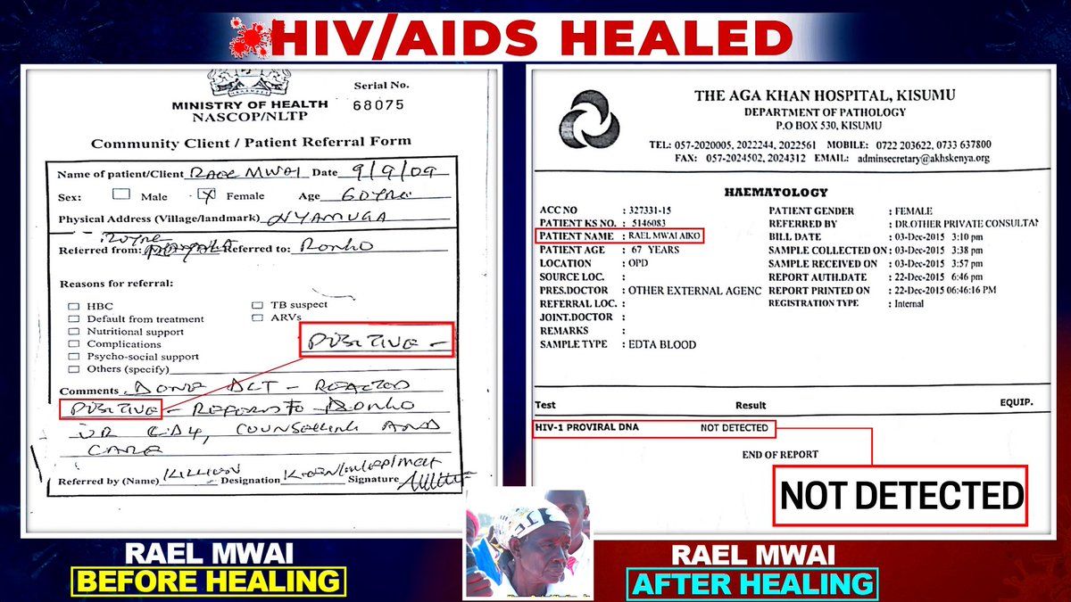 AaronAlmquist1's tweet photo. #HIVHealedInKenya HIV piiloutuu pysyvästi immuunisolujen DNA:han, voi olla vuosikymmeniä täysin näkymättömänä, ja alkaa lisääntyä heti kun lääkitys lopetetaan. Siksi sille ei ole parannuskeinoa - mutta Kenian Herätyksen keskellä Jeesus on parantanut kymmeniä tapauksia! https://t.co/PEjLSIR4b1