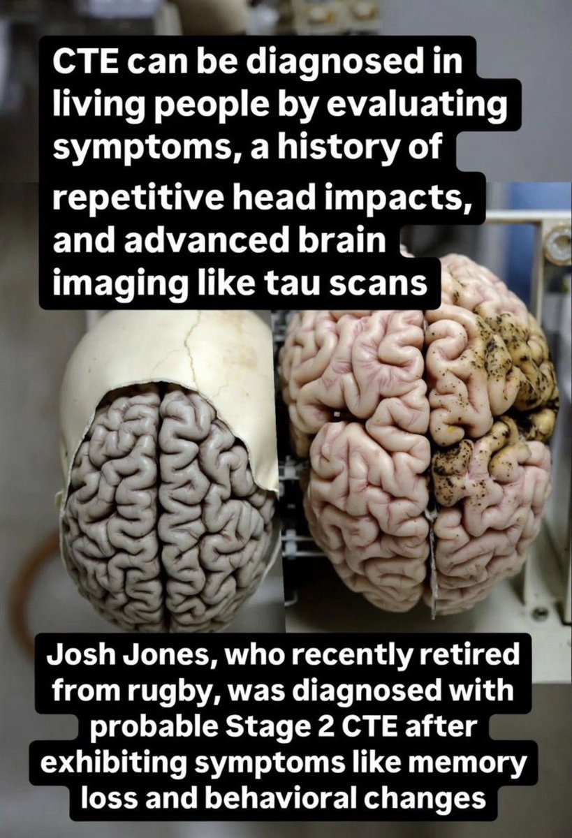 Alix Popham tweet media