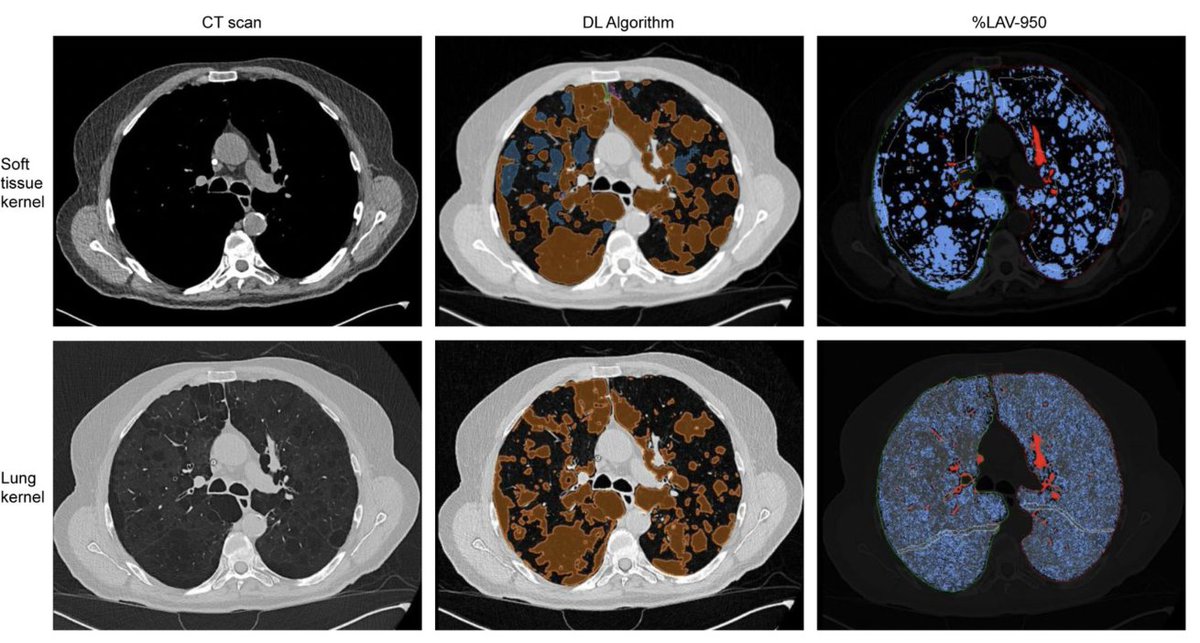 contextflow tweet media