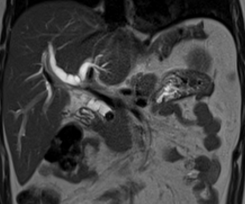 Derby Pancreaticobiliary & Robotic AWR Unit tweet media