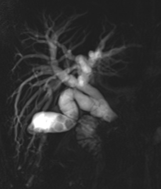 Derby Pancreaticobiliary & Robotic AWR Unit tweet media