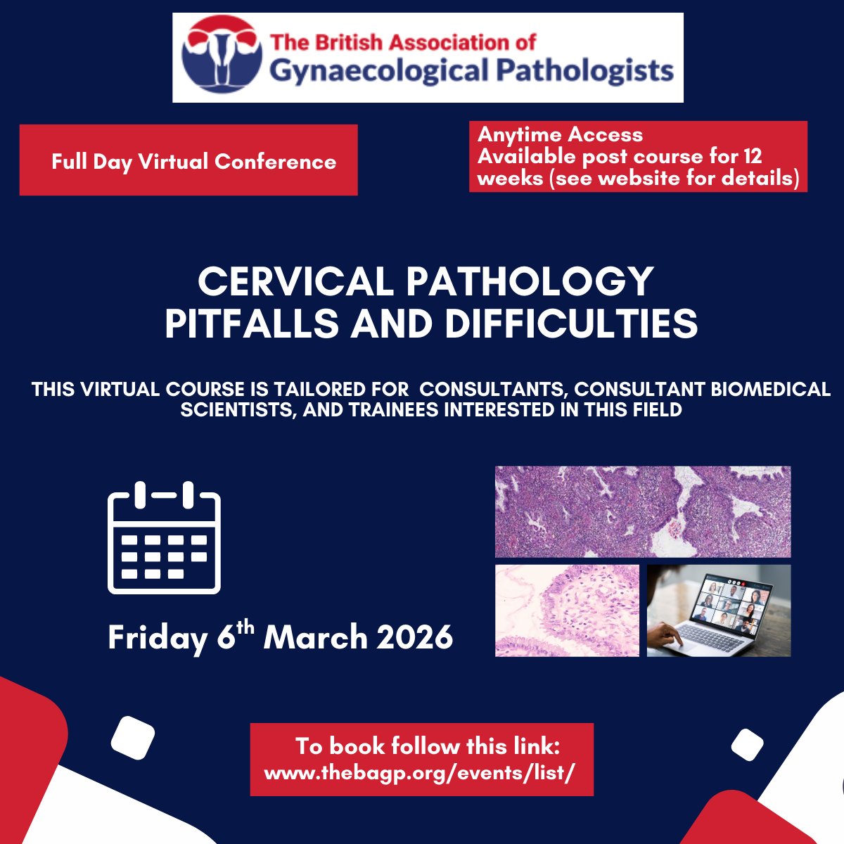 RCPath's tweet photo. 📢 Cervical pathology – pitfalls and difficulties
🧠 Expert talks, live cases and updates on IHC, HPV, staging, SCC and rare entities.
🎥 Can’t attend live? Get 3 months of on-demand access.
👉 Register: https://t.co/RGyPoW1DKq
@BAGPGynPath #Gynaepath #GynPath #PathTwitter https://t.co/jMPq0aufoZ