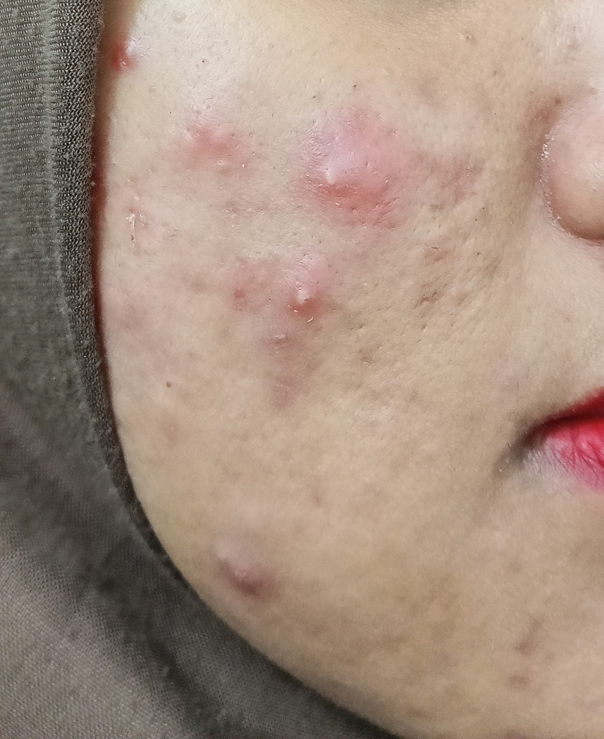 ✨OMBB | 🚫NO LINK tweet media