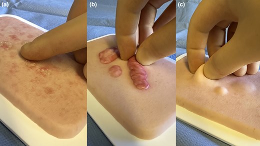 Skin Health and Disease tweet media