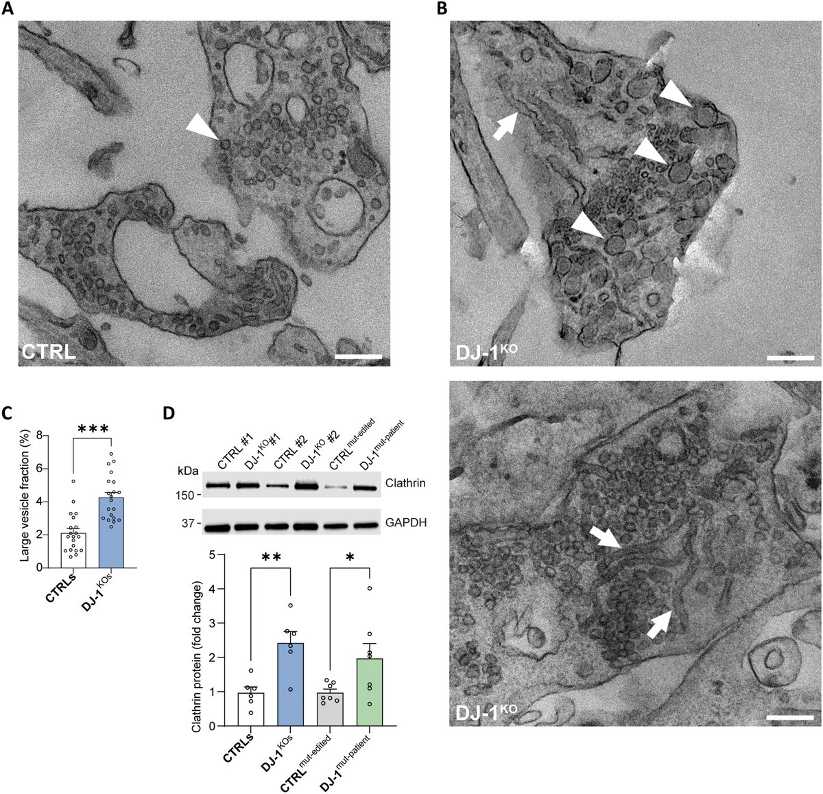 The Science of Parkinson's tweet media