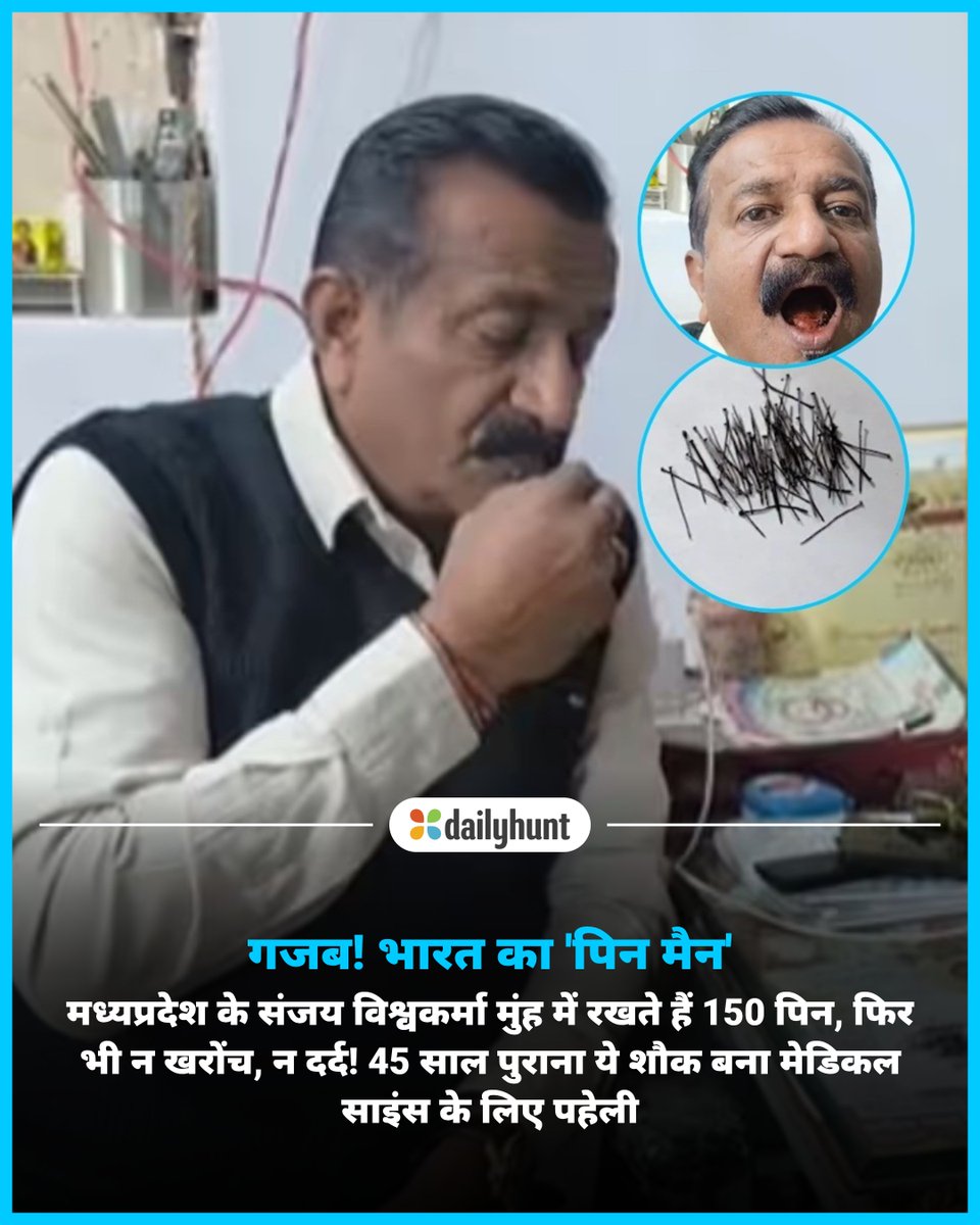 DH_Hindi's tweet image. मेडिकल साइंस के लिए पहेली! शख्स के मुंह में रहती हैं 150+ नुकीली पिन, खाना-पीना-सोना सब इन्हीं के साथ
📸 Credit: नवभारत टाइम्स

Navbharat Times सहित अन्य भरोसेमंद न्यूज़ चैनलों पर पढ़ें पूरी खबर:
w.dhunt.in/13nNwG?partner…

#Satna #PinMan #MadhyaPradesh #MedicalMystery #offbeat