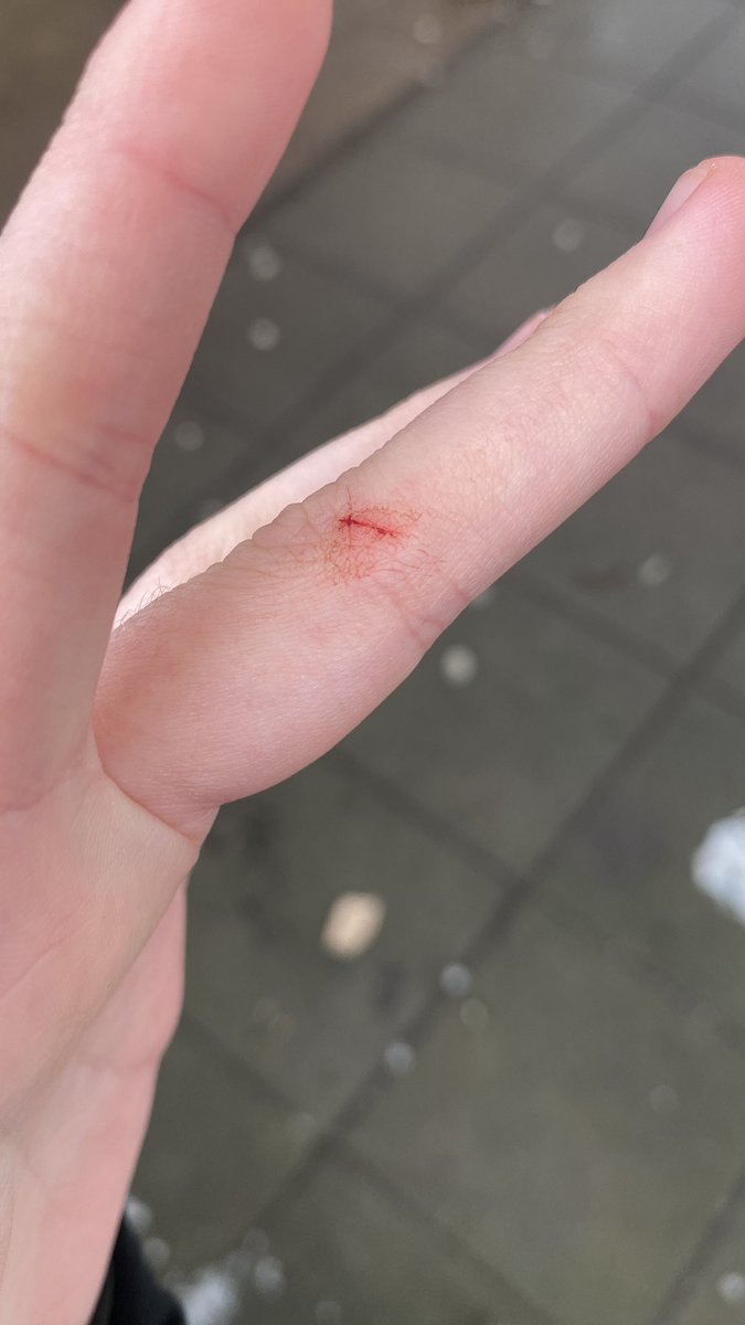 4nonymous_33's tweet photo. Good news I found my missing blades, bad news they were in my pocket https://t.co/ZNa7l5hCaN