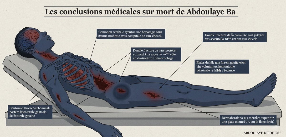 Noo_IDcard's tweet photo. ‼️Les blessures de Abdoulaye Ba d’après l’IA. 9 pointes de blessures https://t.co/y7yUFbvB4X