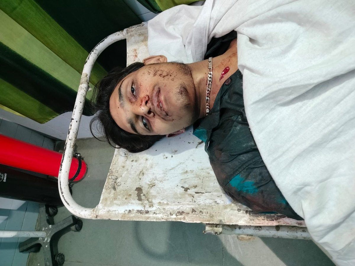 अरशद उर्फ़ असद को मारने वाले जिनका FIR में नाम मेंशन है<a href="/shamlipolice/">Shamli Police</a> ने ग्रिफ़्तार कर 2 आरोपी मिलन और विराट को छोड़ दिया ऐसा क्यों<a href="/dgpup/">DGP UP</a> <a href="/Uppolice/">UP POLICE</a> कृपया संज्ञान लें,अरशद के घर वालों को इंसाफ़ मिलना चाहिए।