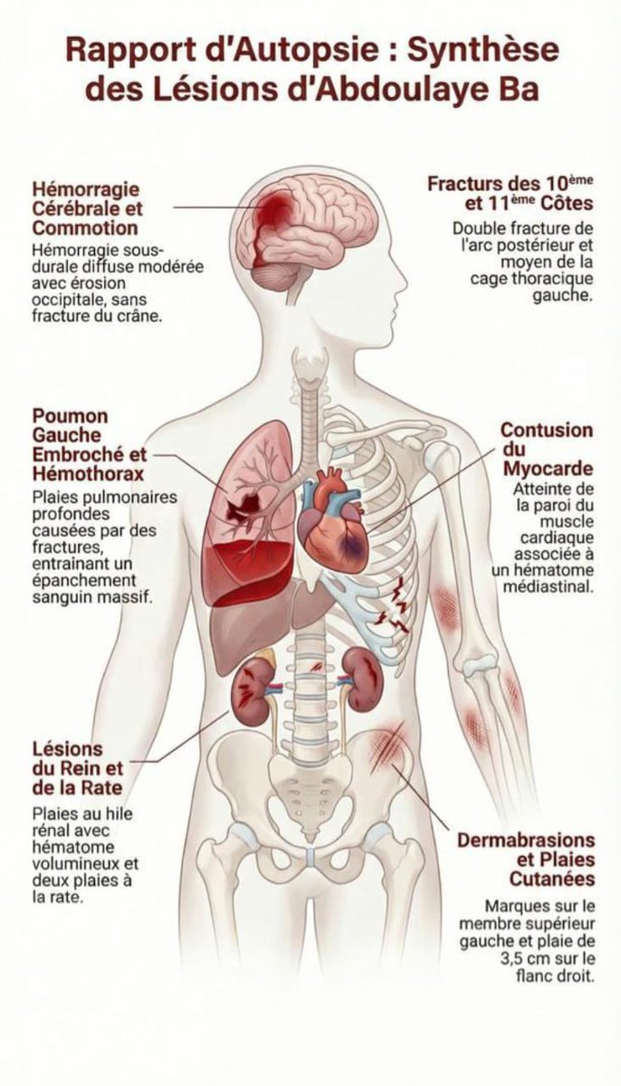 jamaaal_d's tweet photo. C’est ainsi qu’ils ont tué Abdoulaye BA https://t.co/6Dr8Hb2Z8N