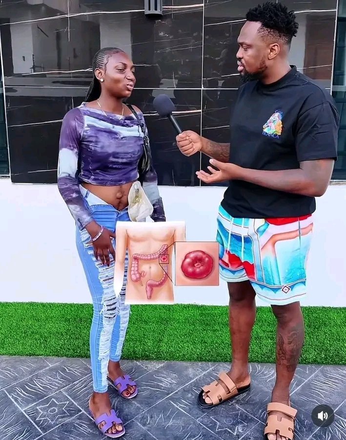 AdageorgeA's tweet image. I just saw a video where Egungu of Lagos interviewed Tobiloba Oluwasina, a lady who is a colorectal cancer survivor and now living with colostomy for over 4years 👍. 
For 4years and counting, Tobi hasn't passed any stool via her änùs , rather all her poos are collected through…