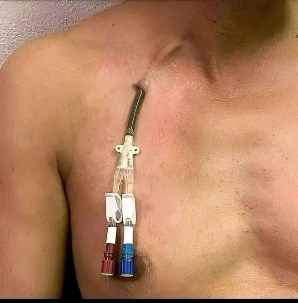 Dr Honey choudhary 🩺 tweet media