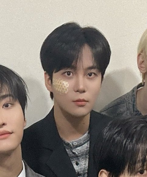 jonghoithoit's tweet image. 눈 밑에 밴드 붙인거 왤케 귀여워