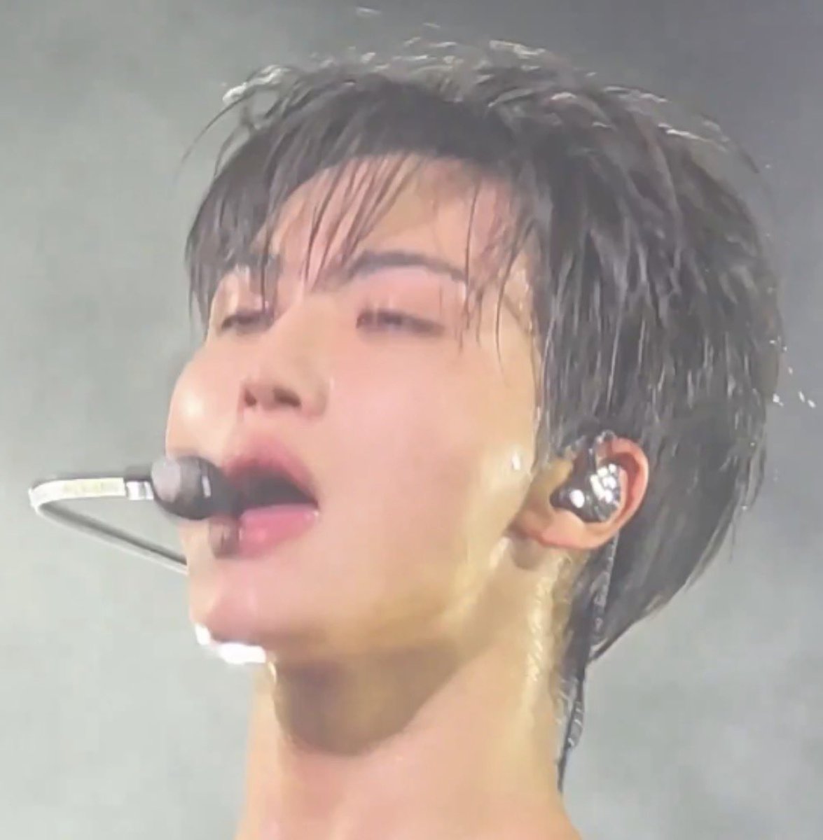 the most serious case of bottom face in human history