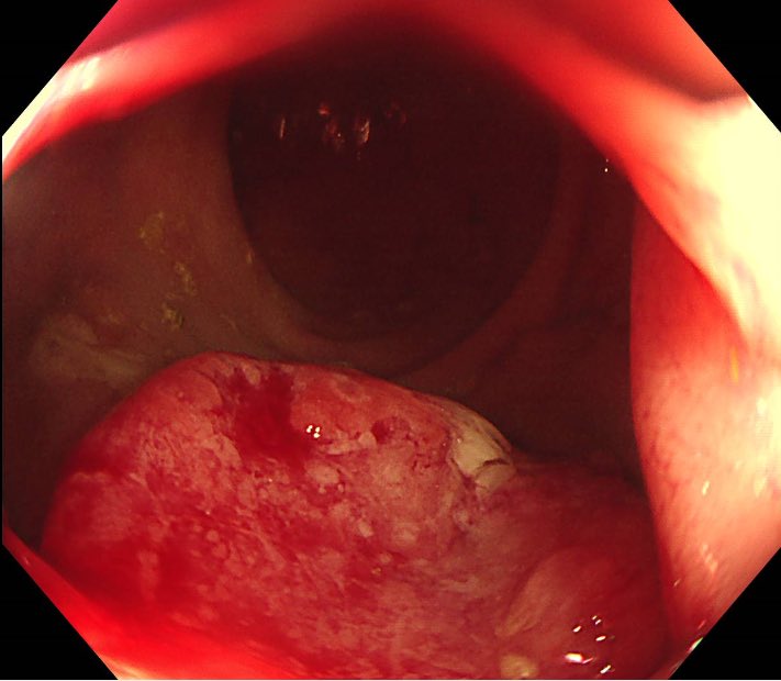 Keith Siau tweet media