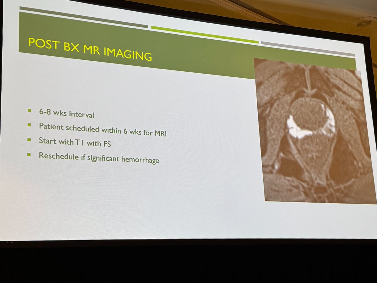 MoffittNews's tweet photo. Live from #AdvancesInUrology: Brandon Manley, MD walks urologists through Prostate MRI 101, discussing why imaging matters and key criteria that can help inform prostate cancer decision-making.

Key takeaways:
• MPR MPRI is the gold standard for prostate cancer detection and staging.
• MRI technique and quality control is crucial.
• Prostate cancer can be multifocal.
• Transition zone cancer is not as uncommon.
• Large FOV images for evaluations of LNDS and bones.
• Awareness of pitfalls.