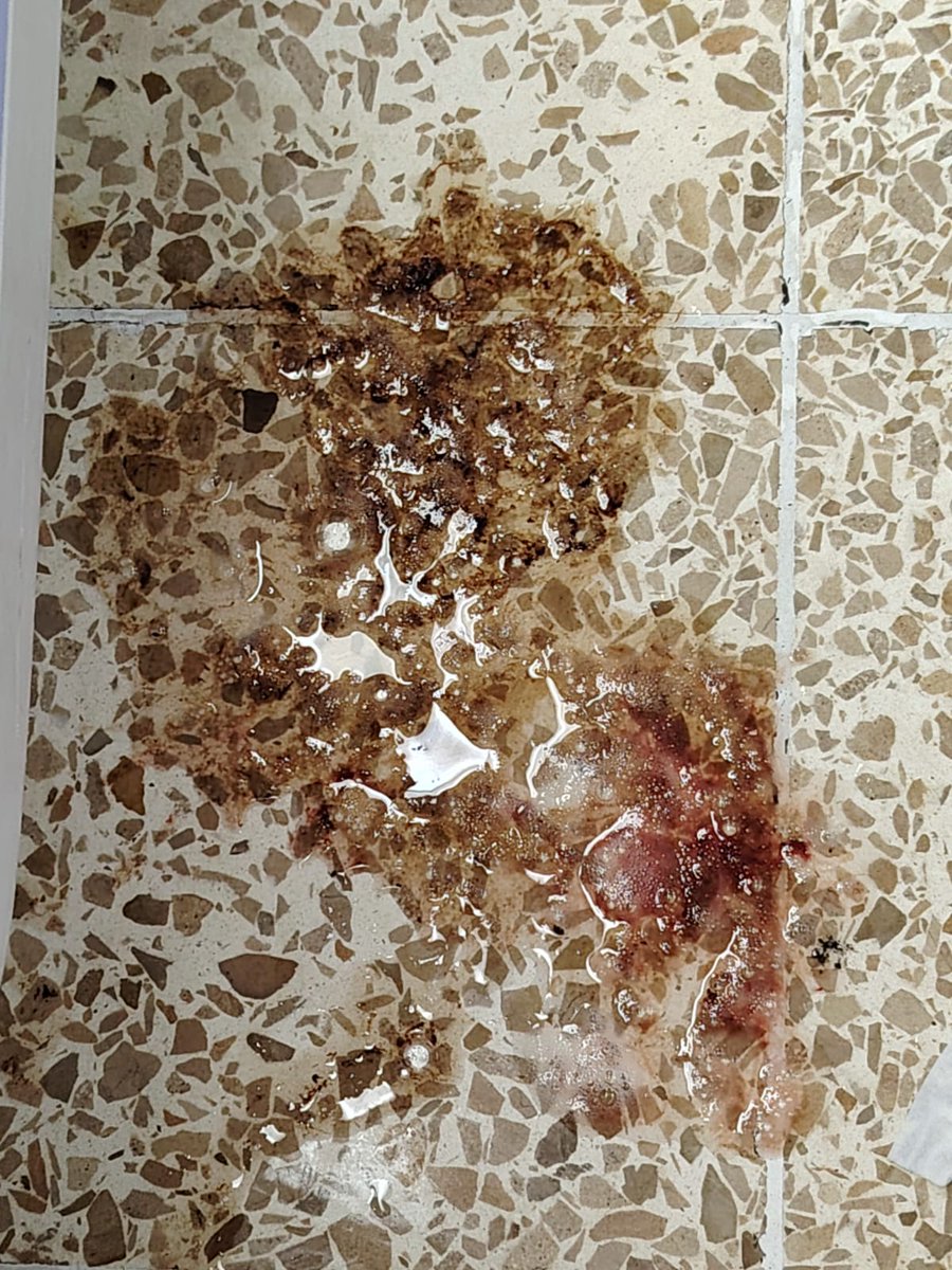 Señor@ ministr@ <a href="/zaidarovira/">Zaida Rovira</a> <a href="/mjpintoec/">María José Pinto 🇪🇨 Ecuador</a> <a href="/Presidencia_Ec/">Presidencia Ecuador 🇪🇨</a> <a href="/DanielNoboaOk/">Daniel Noboa Azin</a> <a href="/goberguayasec/">Gobernación del Guayas</a> <a href="/tctelevision/">TC Televisión</a> <a href="/ecuavisa/">Ecuavisa</a> <a href="/bessygranjaOK/">Bessy Granja Barriga</a> El niño Salomón Ezequiel León Lucin,se encuentra en la sala Gastroenterologia en el #HospitalIcazaBustamante el bebé tiene 10 días en estado crítico.