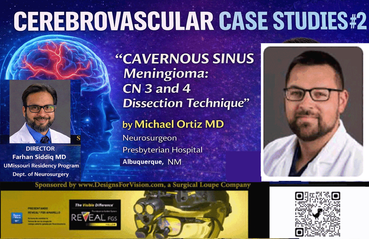 NeuroSurgTV's tweet photo. TOMORROW, 7 am CST, 8 am EST.......https://t.co/kgZc7JfTNk  featuring Michael Ortiz MD (PROFILE: https://t.co/vGDR6PxT2J ) presenting "Cavernous Sinus Meningioma CN 3 and 4 Dissection Technique",  (PROFILE: https://t.co/L15SdT6q4c) ZOOM REGISTRATION: https://t.co/jyAKXgjbR3 https://t.co/krSWdscJgy