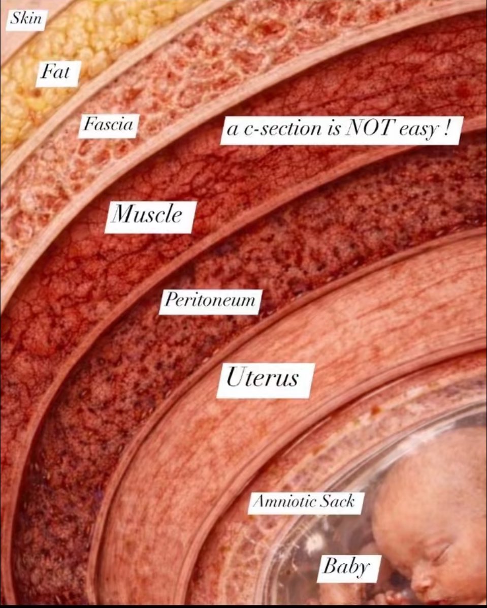 dietd0llx's tweet image. And my scar is STILL not fully gone btw.