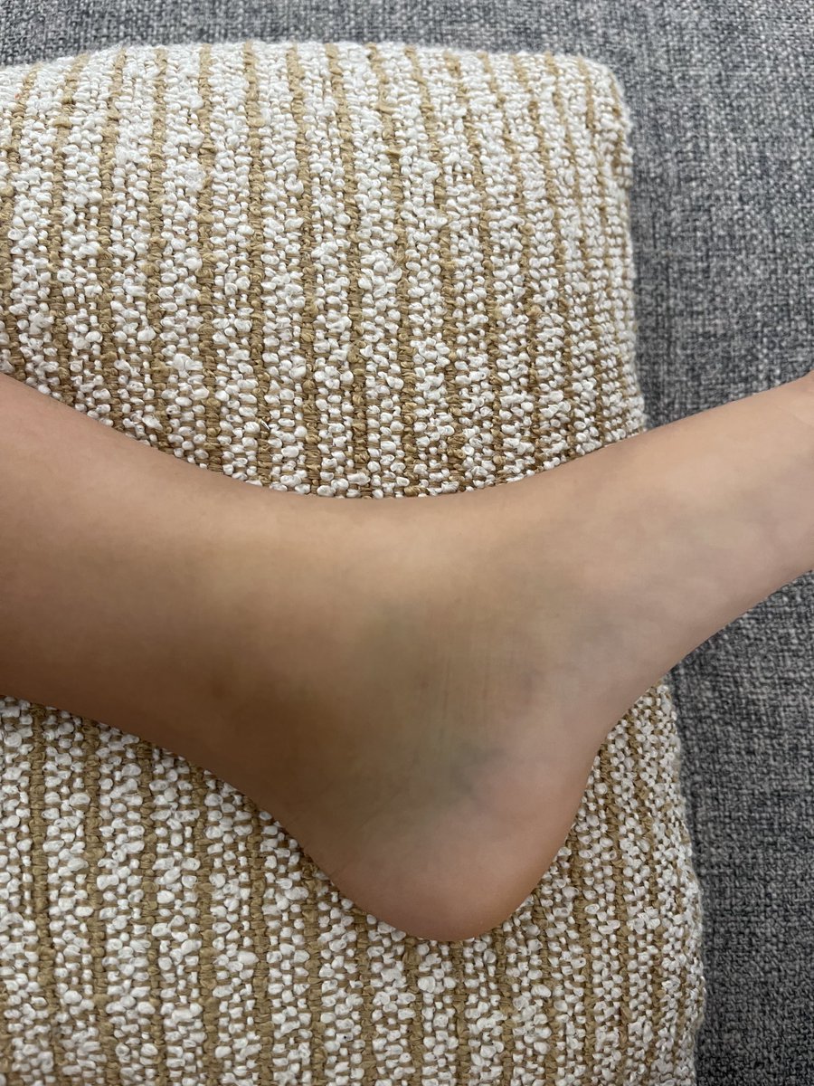 NDMNIII's tweet photo. My daughter was pushed while playing and I’m curious about her injury. She can move laterally without pain, but horizontal movement is painful. https://t.co/Cs0rLRjx0G