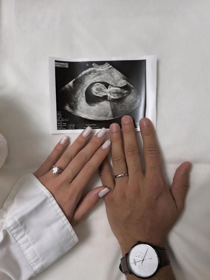 1flowery_'s tweet image. 𝑂𝑛𝑒 𝑑𝑎𝑦 ❤️