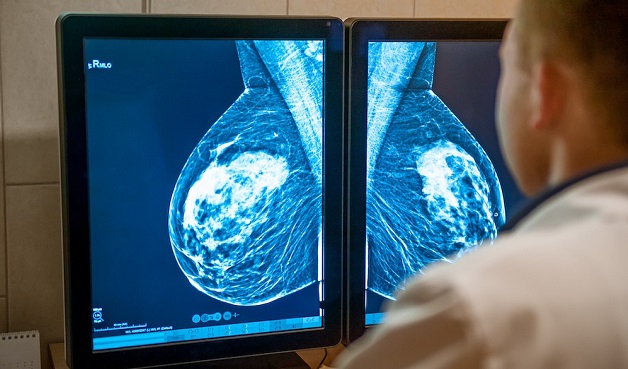 Desarrollan una plataforma de inteligencia artificial para anticipar la probabilidad futura de cáncer de mama.
<a href="/TecdeMonterrey/">Tecnológico de Monterrey</a> <a href="/TecSaludMX/">TecSalud - Sistema de Salud del Tec de Monterrey</a> <a href="/Google/">Google</a> <a href="/googlemexico/">Google México</a> <a href="/googlecloud/">Google Cloud</a> <a href="/GoogleCloudTech/">Google Cloud Tech</a> <a href="/GoogleCloud_LA/">Google Cloud Latinoamérica</a> 
topmanagement.com.mx/desarrollan-un…