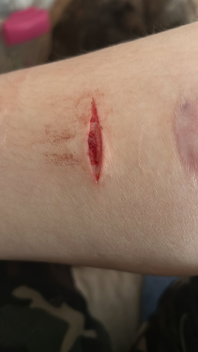 Mutilator69's tweet photo. back at it https://t.co/uibCYS80r4