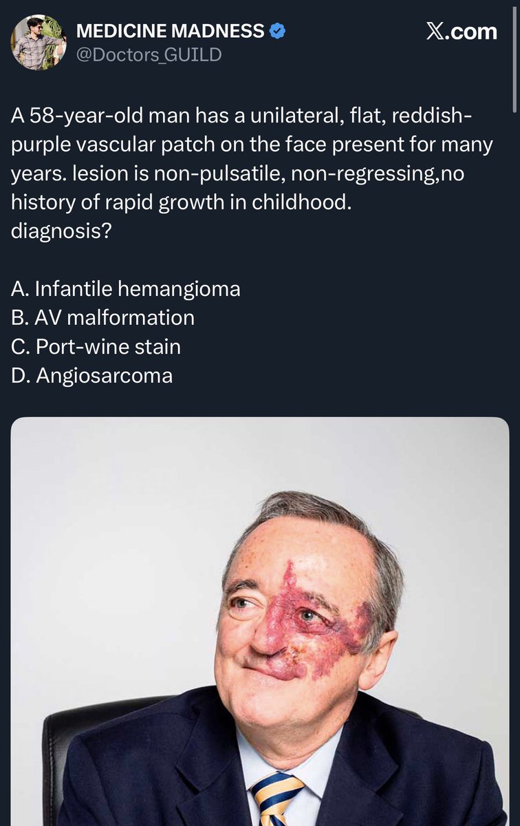 Keith Siau tweet media