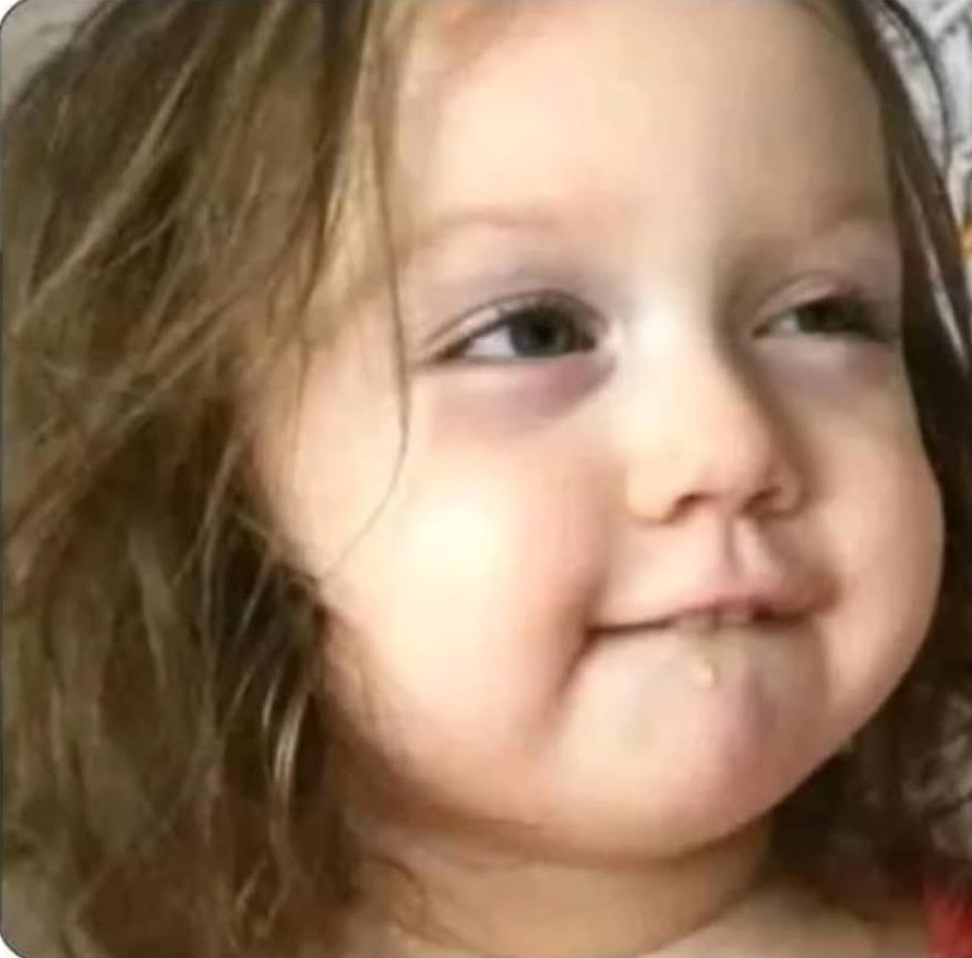 Yo cuando nos recuerdo...