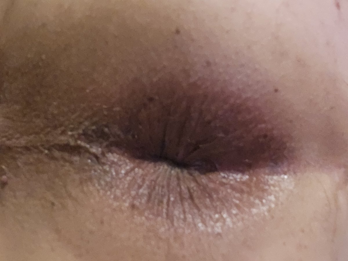 MobileManHunt's tweet photo. It didn't fill up like a water balloon and it didn't leave me gaping 🤭 but you still did good youngster lol
#bwc #bisex #gaysex #safesex #analsex #magnum #condom #bussy #cumshot https://t.co/IuroCpVtY2