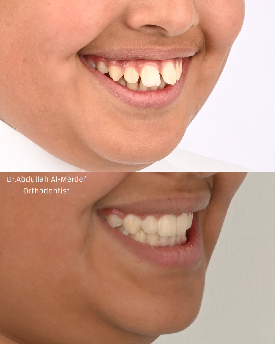 د.عبدالله ال مردف tweet media