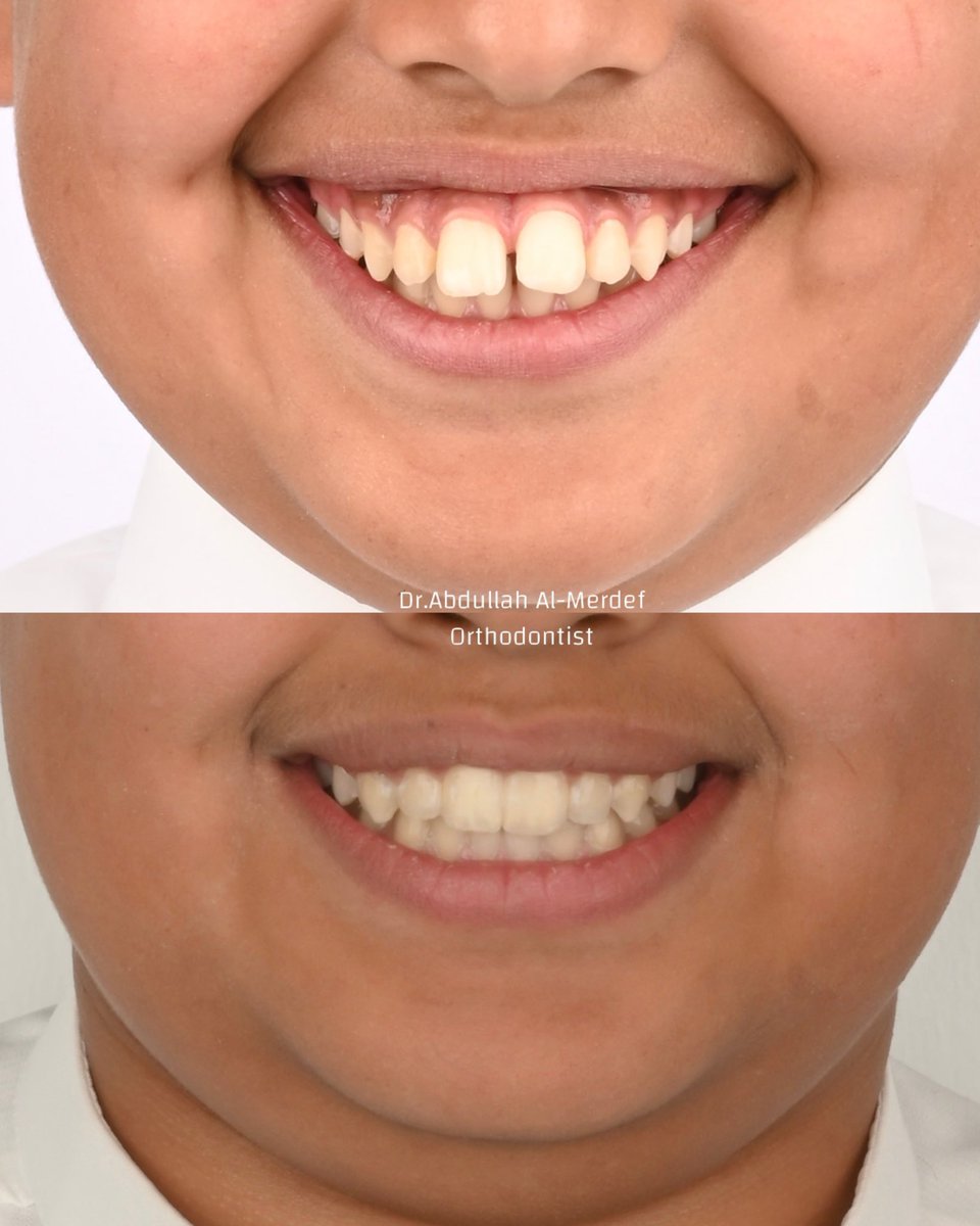 د.عبدالله ال مردف tweet media