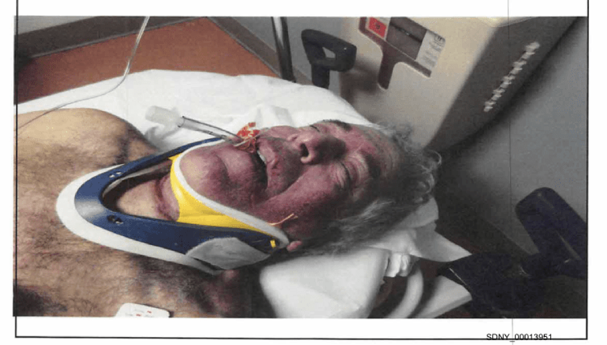 DeprogrammerX's tweet image. In Jeffrey Epstein's suicide report, they show a clear photo of him deceased with abrasions on his neck, but all of the many other photos of him being attended to have his face obscured. Hmmm.